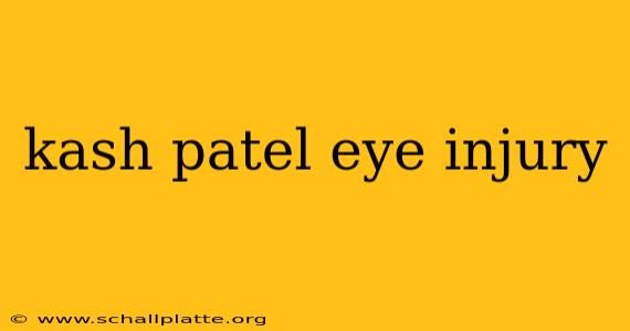kash patel eye injury